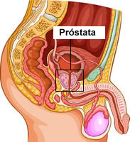 Resumo hiperplasia benigna da próstata